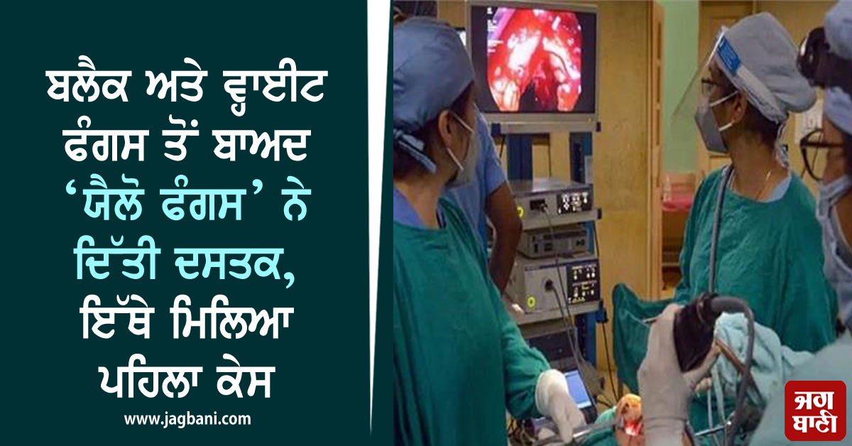 JagbaniOnline's tweet photo. ਬਲੈਕ ਅਤੇ ਵ੍ਹਾਈਟ ਫੰਗਸ ਤੋਂ ਬਾਅਦ ‘ਯੈਲੋ ਫੰਗਸ’ ਨੇ ਦਿੱਤੀ ਦਸਤਕ, ਇੱਥੇ ਮਿਲਿਆ ਪਹਿਲਾ ਕੇਸ
https://t.co/21DJEl9iZS
#YellowFungus #BlackFungus #India #COVID19 #EyesEffect #NationalNews #JAGBANI https://t.co/9faSk5tgZO