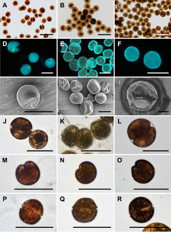 protistologists's tweet photo. First report of Alexandrium (Dinophyceae) associated with marine macroalgae off Japan: Diversity, distribution, and toxicity https://t.co/HBUfC9QQJz #protists #algae https://t.co/tKQVSGVKjE