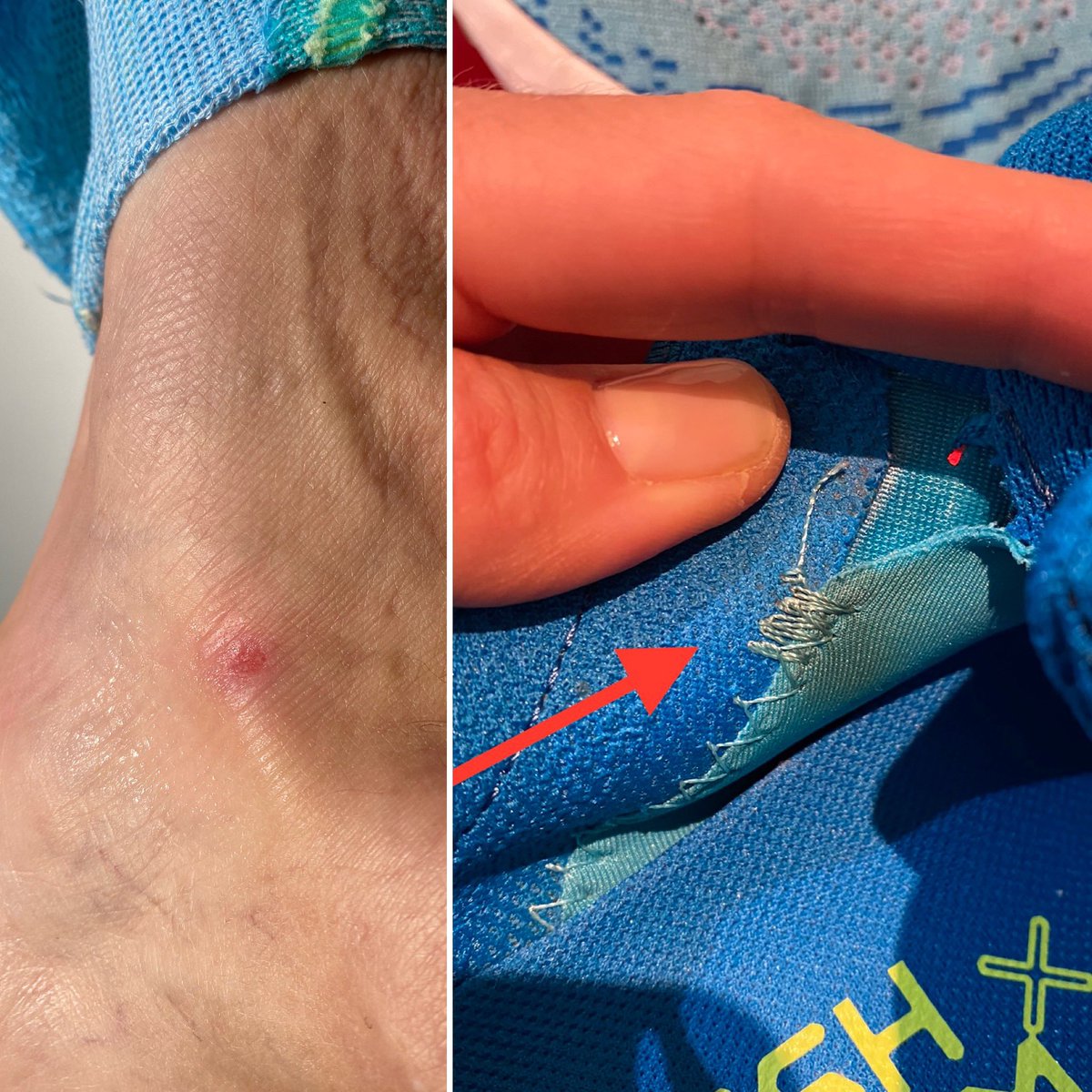 suzisnell's tweet photo. @NewBalance_SA @SportsmansW while u take “2-3weeks” to see if excess stitching on #Freshfoam plausible cause of blistering on habitual 1080 customer, should said customer just train in #asics til u done? https://t.co/I5GdrCqGPY