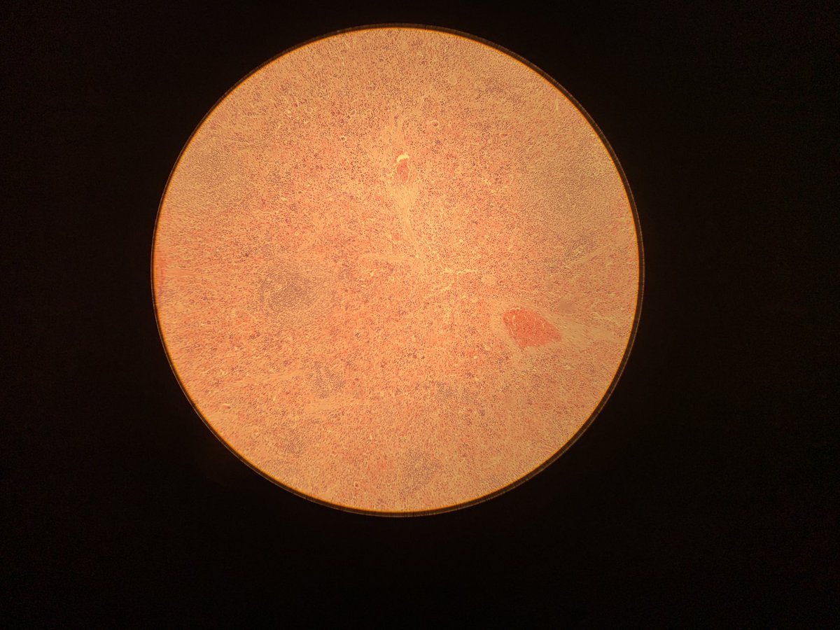 JManuel_87's tweet photo. Bazo, en el que observamos Corpúsculos de Malpighi y pulpa roja rodeándola. #histomed164 @HistologiaC https://t.co/WyPSy4fXO3