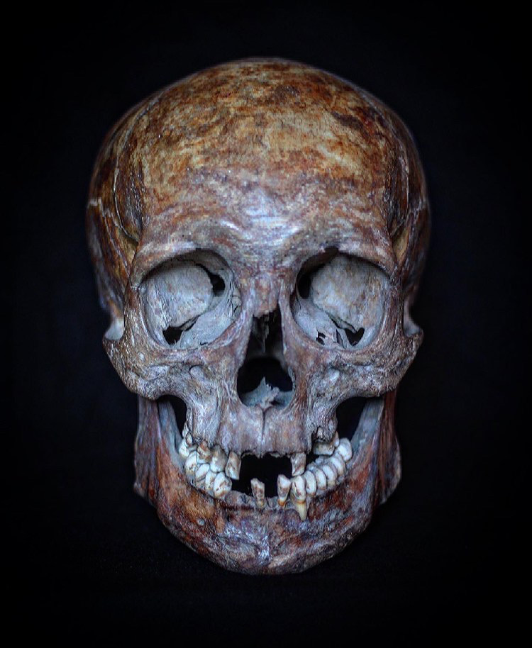 bonesforensic's tweet image. 