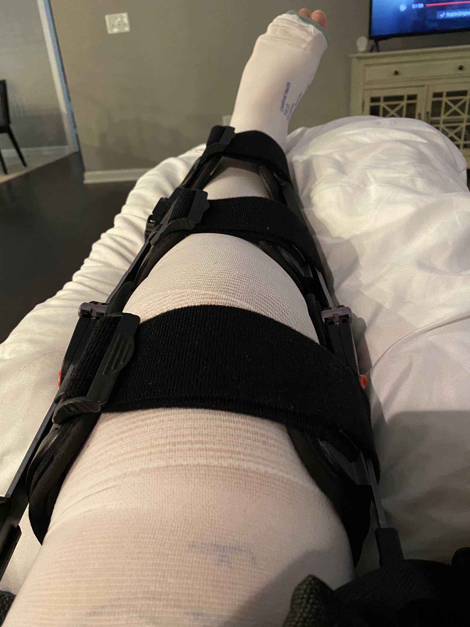 First Week Post Surgery, How High Do I Elevate My Leg? I, 58 OFF