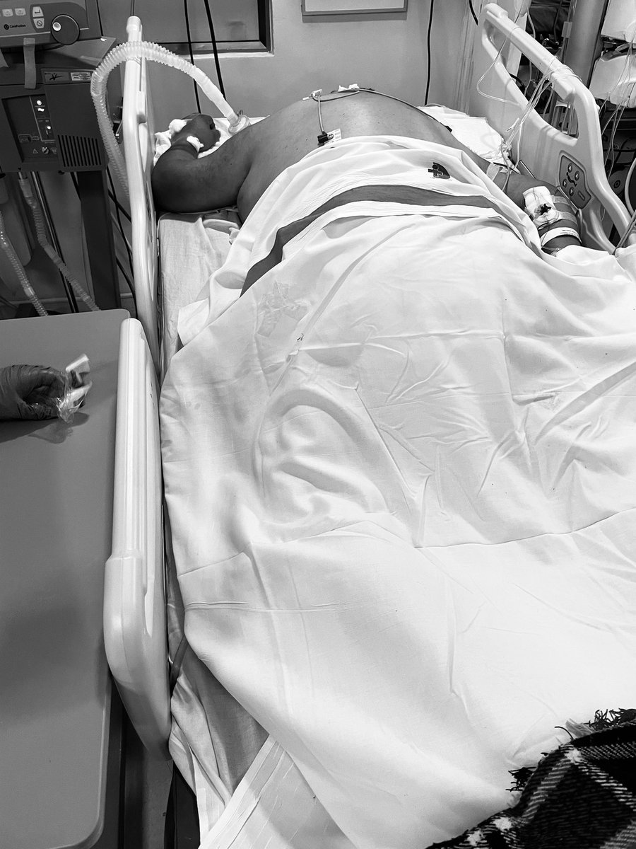 Estamos viendo el peor momento, Covid está lejos de bajar, la sensación de la calle es que todo pasó y hay tacos. Urgencias sin capacidad de atender emergencias, atendiendo Hospitalizados. #Covidchile <a href="/sochimu/">SOCHIMU</a> <a href="/MUE_14/">eMUE</a>
