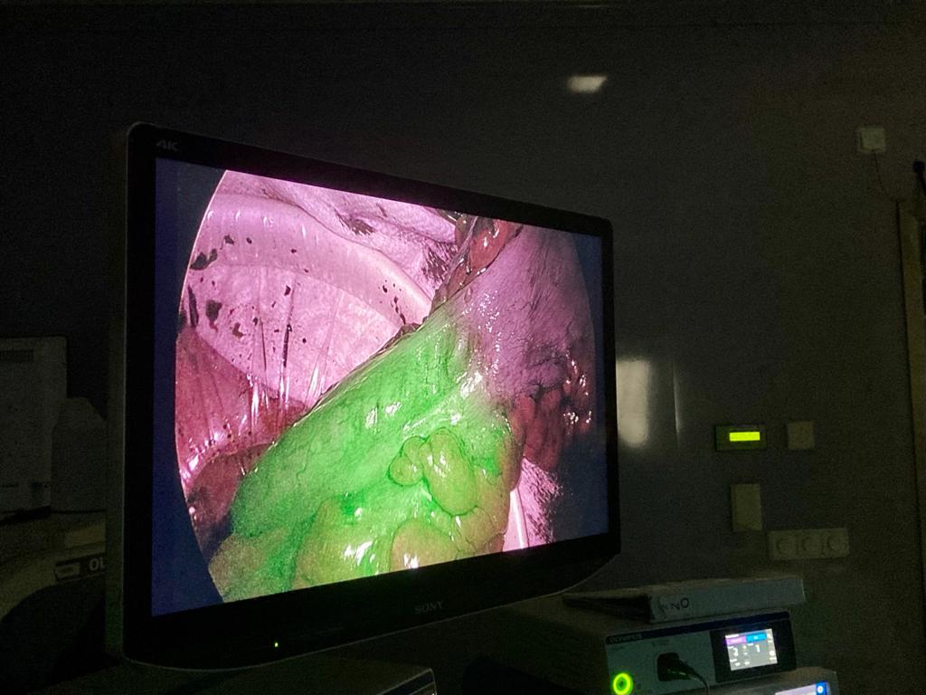 TatianaOlympus's tweet photo. Empezamos la semana con el primer Curso presencial de Cirugía de Colon de la mano de @smoralesconde, Dr. Alarcón y @SebJeri21 con tecnología #ICG combinado con #Thunderbeat
@apozo_surgical
#OlympusIberia #MedicalExpertTraining https://t.co/1Ub1FJKclZ