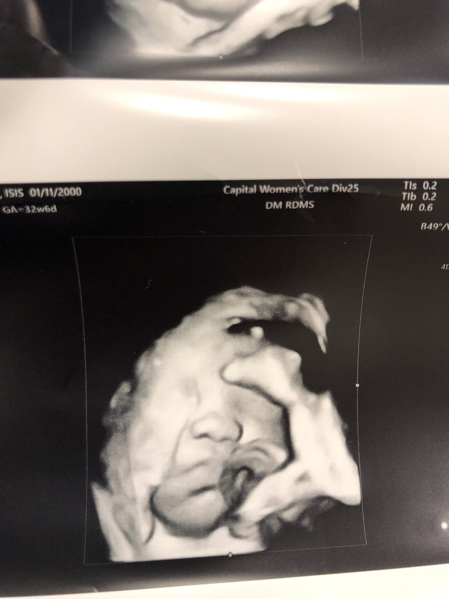 isis_taelorr's tweet photo. Like father like son 😭🥲💕 
#reypop #33weeks #6lbs https://t.co/0GopaDoAkh
