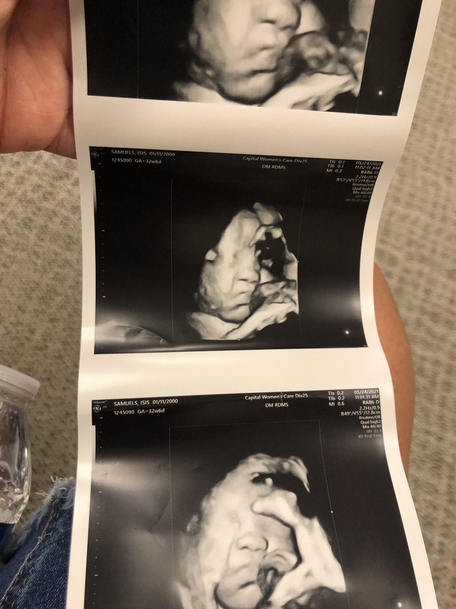 isis_taelorr's tweet photo. Like father like son 😭🥲💕 
#reypop #33weeks #6lbs https://t.co/0GopaDoAkh