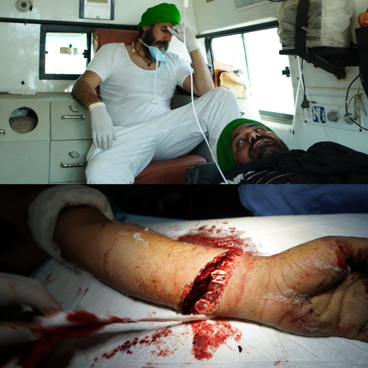SinghSwaiman's tweet photo. Nonviolent protest?  When we said that this will be a nonviolent protest we were only taking about the farmers.  The violence and the pain that farmers had and will have to endure is our business. The hand you see is of a farmer who showed up to our clinic with his arm in blood. https://t.co/BE2riWQRmt