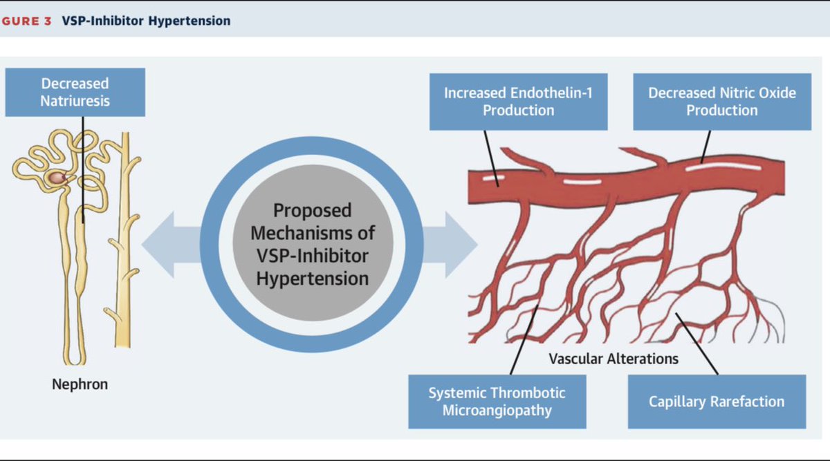HanCardiomd's tweet photo. This is an fantastic article on Clinical Approach to Cardiovascular Toxicity of Oral Antineoplastic Agents: @JACCJournals State-of-the-Art Review https://t.co/3ufd474vr9 Great work by @Vijayrao7474 @Dr_Mike_Fradley @sdent_duke @AnaBaracCardio @RupalOQuinn @DrRyanPDaly https://t.co/d6KPzjEk16