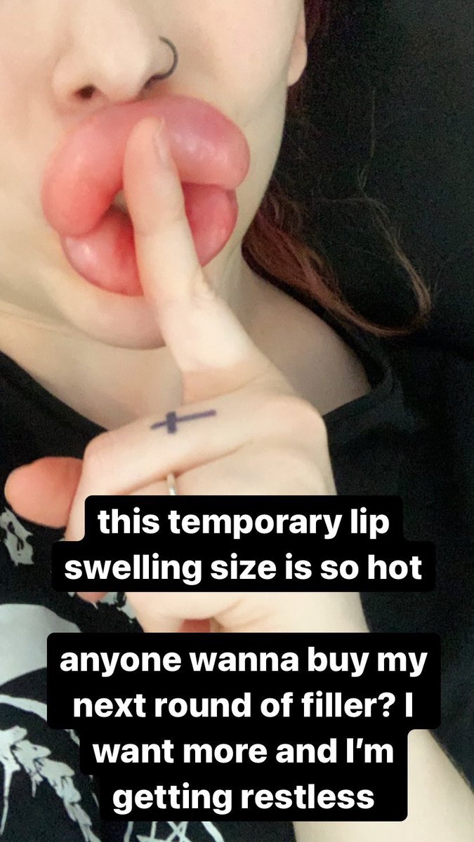 SiliconeCyborg's tweet photo. #filler #lipfiller #lipfetish #bimbofication #bimbodoll https://t.co/hMZUVzQ2Kc