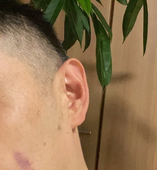 @sadycork 占いお好きかわかりませんが、佐渡島さんの耳たぶは「財産をつくる」相みたいです

https://t.co/bjjoiXLXWK 