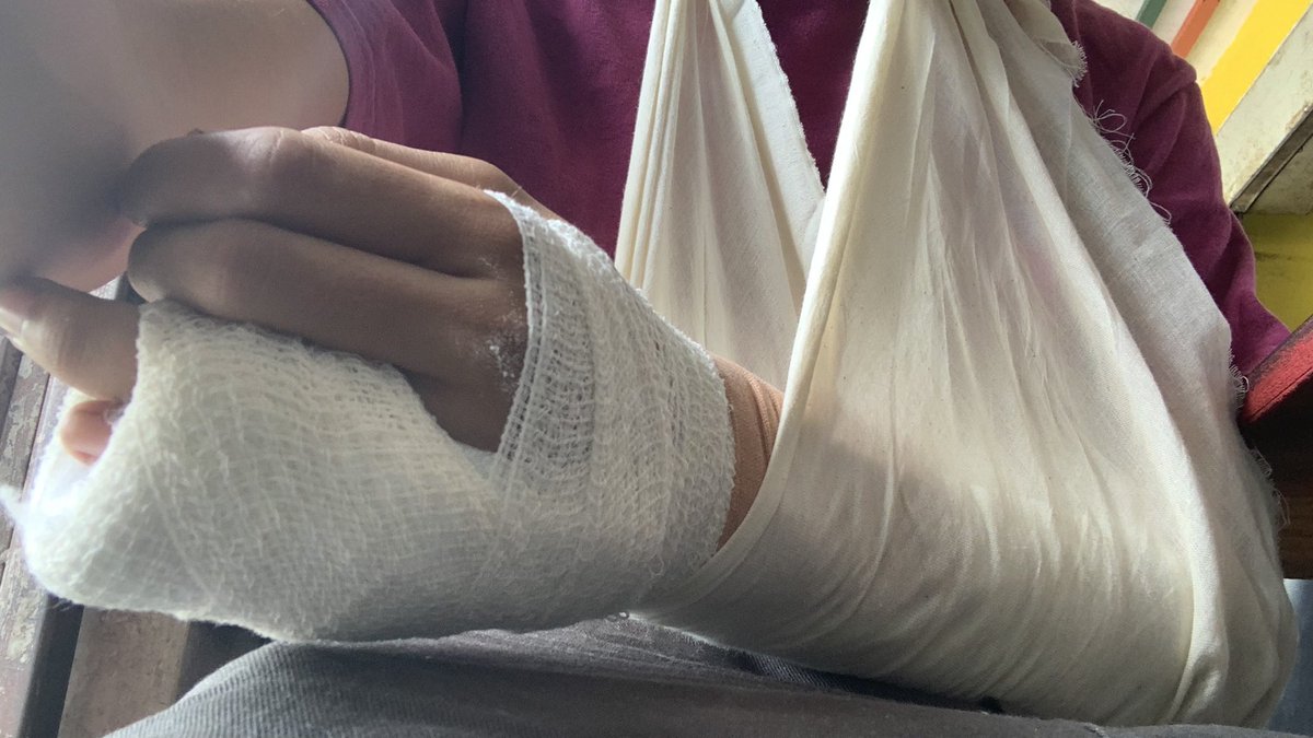 natso_hot's tweet photo. Lost my left toenail, cracked my left pinky palm https://t.co/K8mxPxEYnj