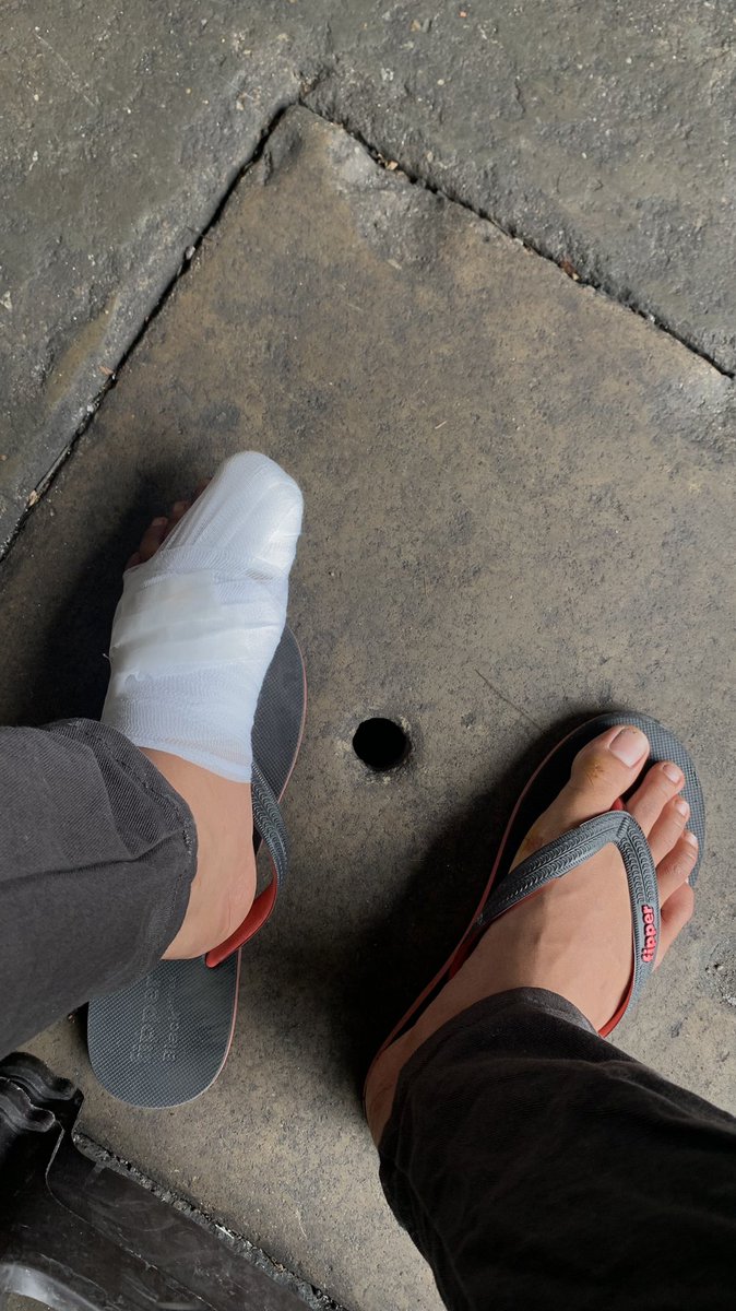 natso_hot's tweet photo. Lost my left toenail, cracked my left pinky palm https://t.co/K8mxPxEYnj