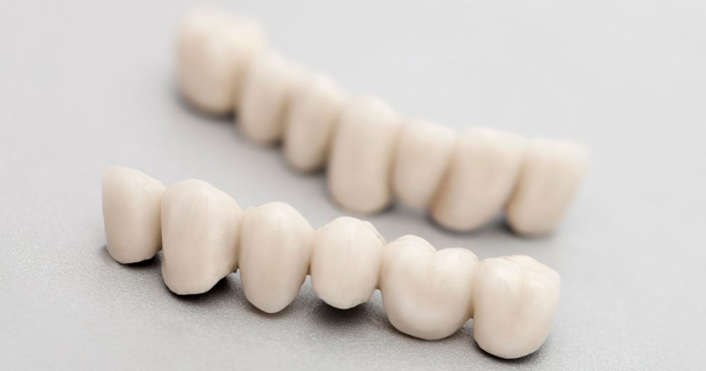 OrchardsScotts's tweet photo. What exactly can you expect when getting a #dental crown? Common questions about the procedure answered. https://t.co/ng7bBbEsRe #smile #invisalign #beautifulsmile #smilebeautiful #straightteeth #braces #clearaligners #teethstraightening #smilemakeover #dentalcrowns #crowns ... https://t.co/tA4geAH7S3