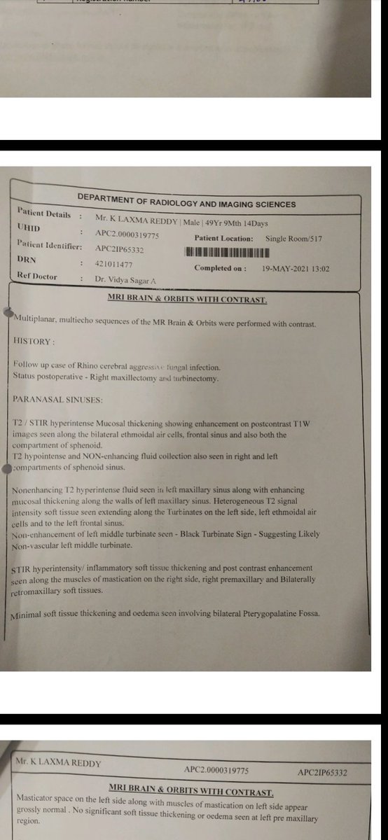 Manish_reddy36's tweet photo. Respected sir @KTRTRS 
My uncle was was admitted in apollo hospital secunderabad due to black fungs, in critical condition he needs amphotericin B injection 6 per day for a week, no response from ent-mcrm, please help sir 🙏🙏 
9705095039
 @KTRoffice @KTRoffice https://t.co/HDvFr35y2E