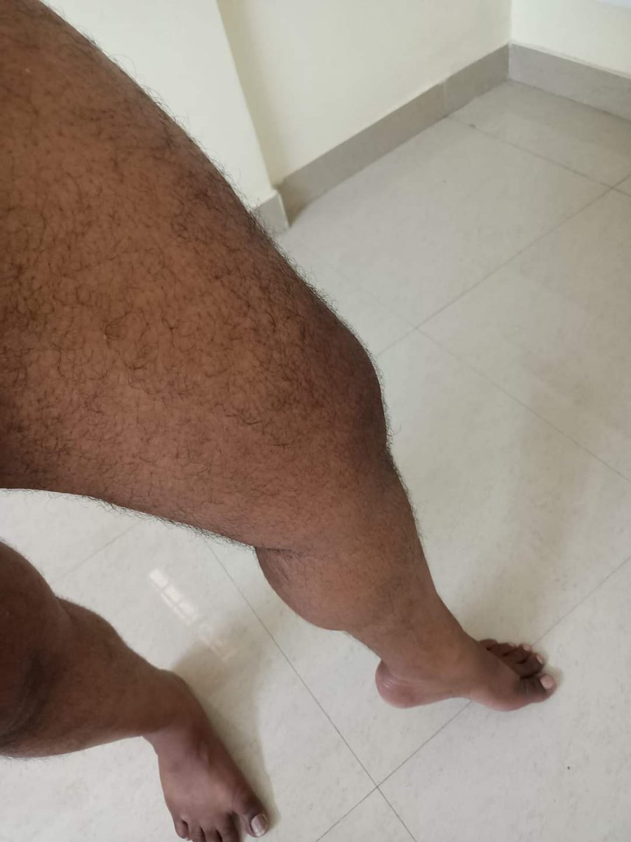 Srikanth_bi's tweet photo. #manthighs #hairylegs #hairythighs https://t.co/5E6aJ1uprK