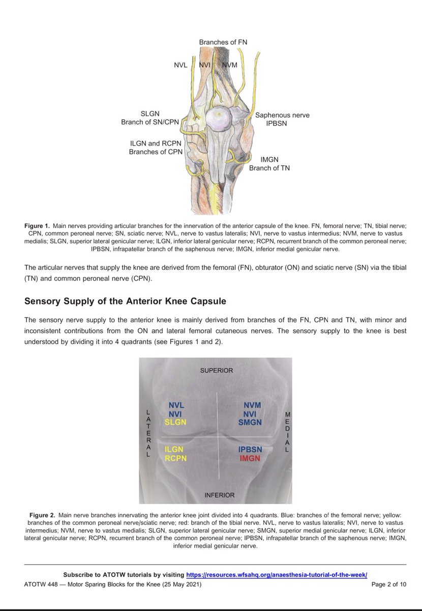 Dr Amit Pawa💉🎙️ (@amit_pawa) on Twitter photo Amazing work once again from our <a href="/RegionalAnaesUK/">RA-UK</a> board member <a href="/mariapsebastian/">Mariapaz Sebastian</a> and team - edited by <a href="/uclhregional/">Dr Simeon West</a>
#MotorSparingKneeBlocks
#RoleModel
More learning to do post #RAUK21!
resources.wfsahq.org/wp-content/upl… Amazing work once again from our <a href="/RegionalAnaesUK/">RA-UK</a> board member <a href="/mariapsebastian/">Mariapaz Sebastian</a> and team - edited by <a href="/uclhregional/">Dr Simeon West</a>
#MotorSparingKneeBlocks
#RoleModel
More learning to do post #RAUK21!
resources.wfsahq.org/wp-content/upl…