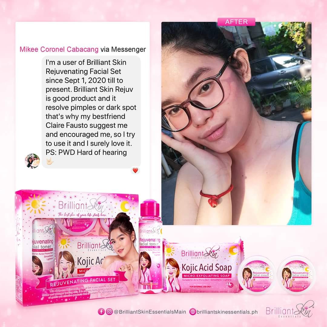 CabacangMikee's tweet photo. @IamMissGlenda I'm hard of hearing PWD. https://t.co/XT7L5xTqBI