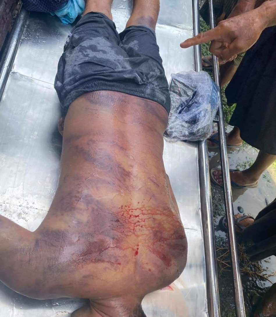 shafiur's tweet photo. #May25Coup Myotha Ward, Kalay

TORTURE AND DEATH IN DETENTION

Unmistakeable signs of torture. Chest and abdomen opened. 

Ko Min Min was abducted yesterday. See my previous tweet 

#WhatsHappeningInMyanmar #Myanmar https://t.co/QaAe8AiYSS