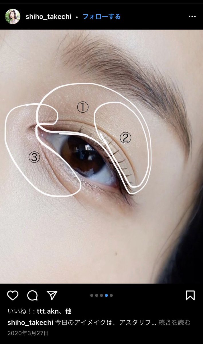 紫 頬顎下脂肪吸引 ジョールファット 結膜脱脂 鼻孔縁挙上dt 武智志穂ちゃんと青柳文子ちゃんのメイクがとっても可愛かったのでフラロッソor02とチークのコーラル買いました 半額だし