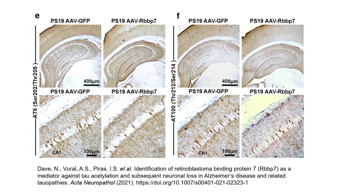 Interested in #epigenetics and #Alzheimers disease? Learn how Rbbp7 and p300 can influence tau #acetylation in the latest manuscript from Dave et al.
#PRC2 #dementia #amyloid 
rdcu.be/ckZFF
<a href="/NikhilDave__/">Nikhil Dave</a> 
<a href="/ASU/">Arizona State University</a>
<a href="/ASUBiodesign/">Biodesign Institute at Arizona State University</a>
<a href="/asuSOLS/">ASU School of Life Sciences</a>