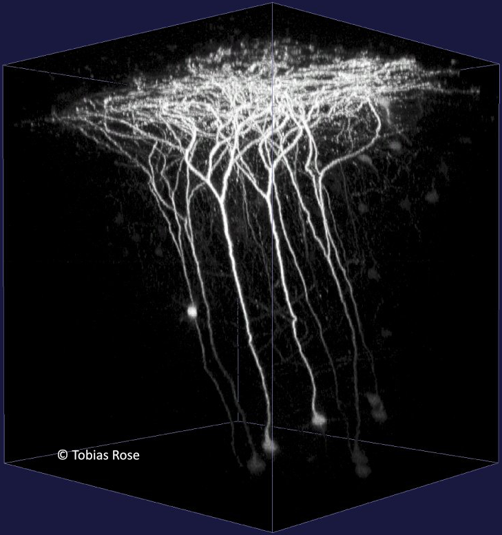 Rheinische Friedrich-Wilhelms-Universität Bonn (@unibonn) on Twitter photo Insights into the brain🧠: <a href="/dfg_public/">DFG public | @dfg_public@wisskomm.social</a> funds the CRC "Synaptic Micronetworks in Health and Disease" at the University of Bonn for another four years. Congratulations!🎉Read more: uni-bonn.de/en/news/113-20… Insights into the brain🧠: <a href="/dfg_public/">DFG public | @dfg_public@wisskomm.social</a> funds the CRC "Synaptic Micronetworks in Health and Disease" at the University of Bonn for another four years. Congratulations!🎉Read more: uni-bonn.de/en/news/113-20…
