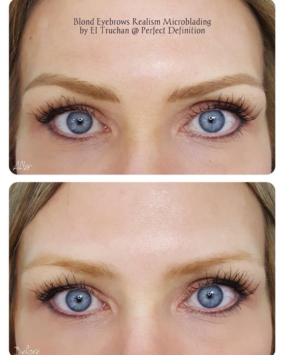 ElTruchan's tweet image. Blonde Eyebrows Realism Microblading by El Truchan @ Perfect Definition
#digitalmicroblading #hairstrokes #browqueen #browformation #nanoblading #nano-blading #microfeathering #microshading #kbpro  #completeyebrows #killerbeautypmu #perfectdefinition