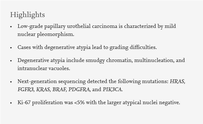 Human_Pathology's tweet photo. #HumPathol #RecentArticle

@Andres_Matoso et al. address difficulties in grading noninvasive low-grade papillary urothelial carcinoma with significant nuclear pleomorphism and degenerative atypia #GUPath #Pathology https://t.co/Bi6fsuKq40