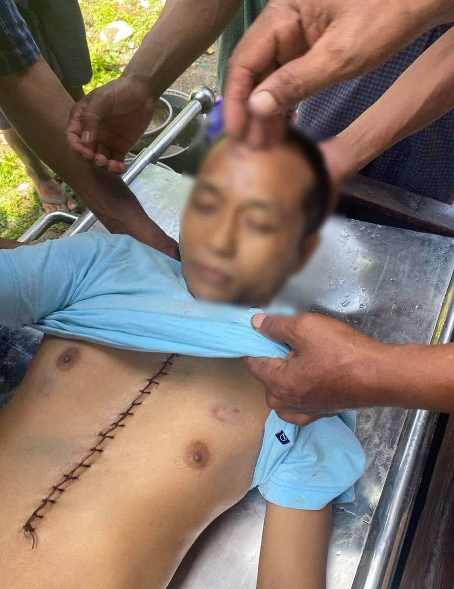 KKhamstar's tweet photo. Ko Min Min from #Kalay died due to brutal tortures by facist military terrorists. He was abducted on May 24th afternoon.

Photo-CJ

#WhatsHappeningInMyanmar
#May25Coup
https://t.co/Tdy71qN8bq
