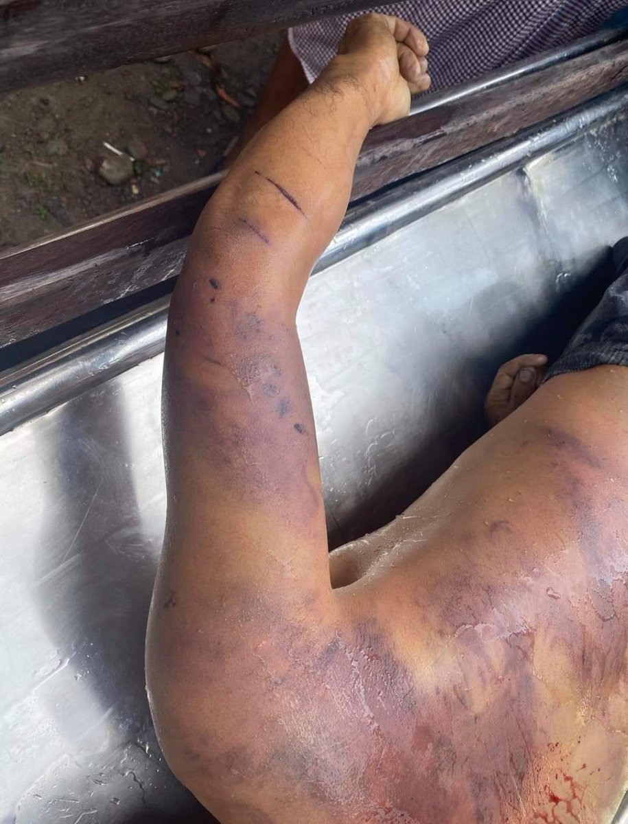 KKhamstar's tweet photo. Ko Min Min from #Kalay died due to brutal tortures by facist military terrorists. He was abducted on May 24th afternoon.

Photo-CJ

#WhatsHappeningInMyanmar
#May25Coup
https://t.co/Tdy71qN8bq
