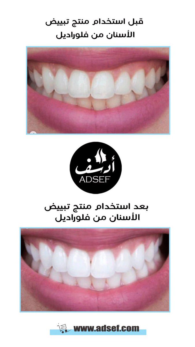 ADSEF tweet media