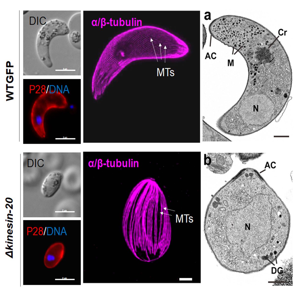 Fascinating biology of kinesin-20 in Plasmodium ookinete shape and motility. Join us at BioMalPar #EMBLMalaria, @RitaTewari @BrochetLab @KarineLeRoch1 @CarolynMoores1