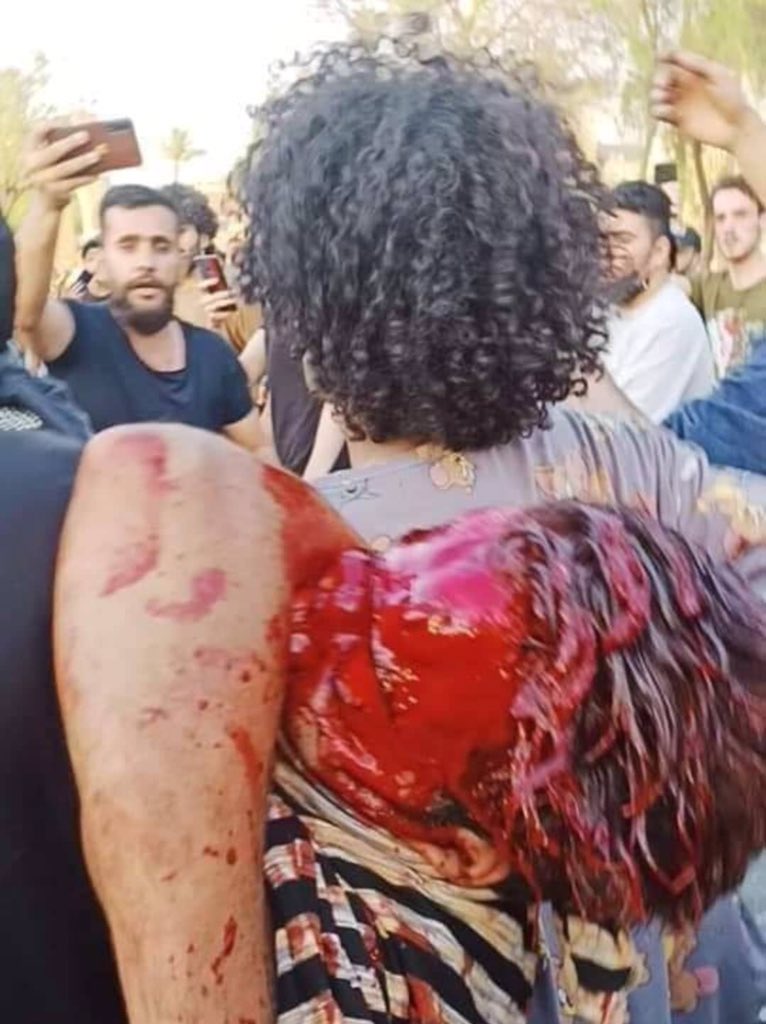 شهيـد شهيدين ب مظاهرات سلمية تُطلب الحرية !! ، هذا دم مو عصير ترا 
#العدلين_راجعين  
#العراق_ينتفض