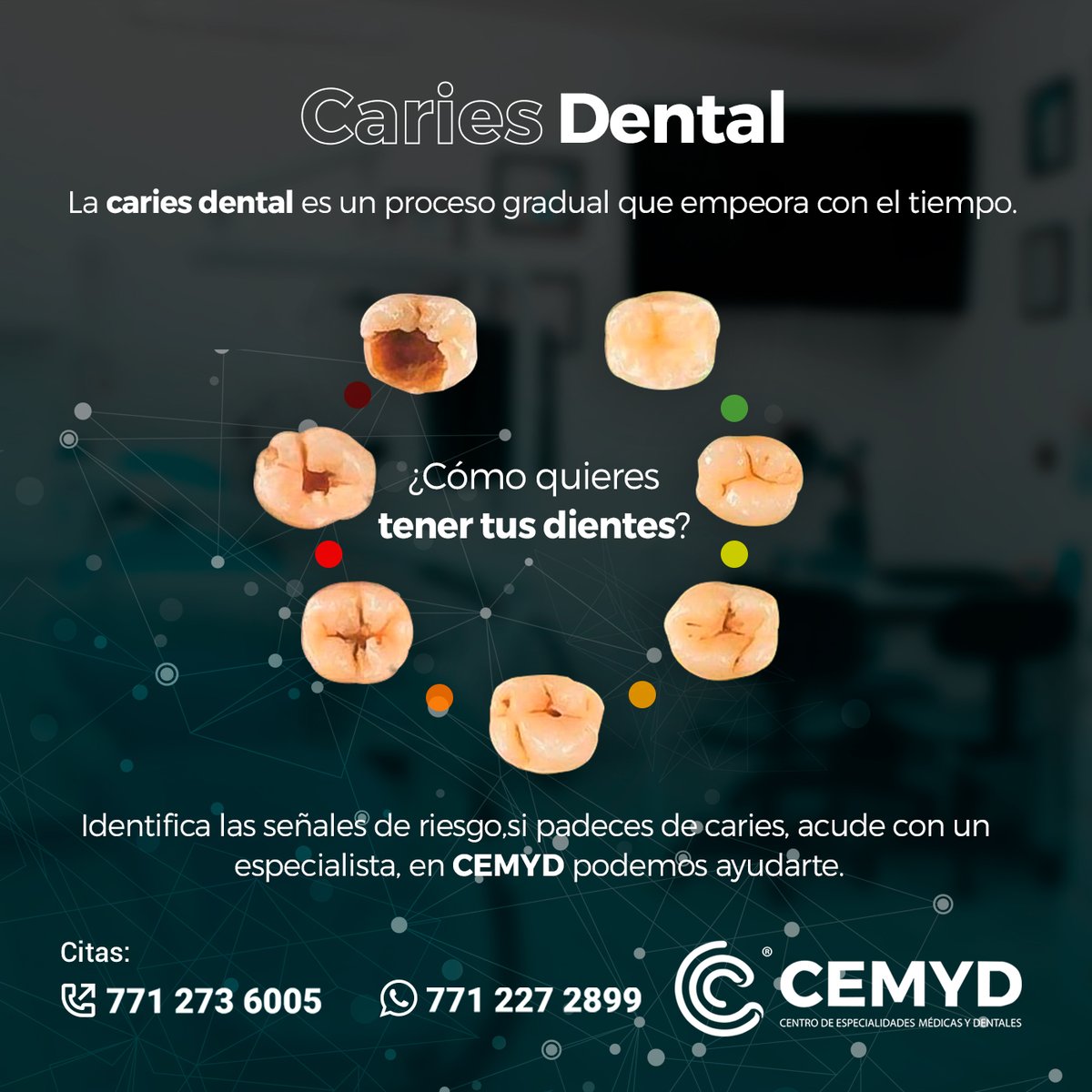 Cemyd1's tweet photo. El mejor remedio para las caries es darles una atención temprana.
No esperes hasta sentir dolor para acudir con tu dentista. 🦷💙

#CEMYDteCuida #Sonrisa #SaludBucal #DientesLimpios #Pachuca #Salud #DientesSanos #ResinasDentales #3M #Resinas3m #Caries #Prevención  #DientesSanos https://t.co/rMDXFYVqnf