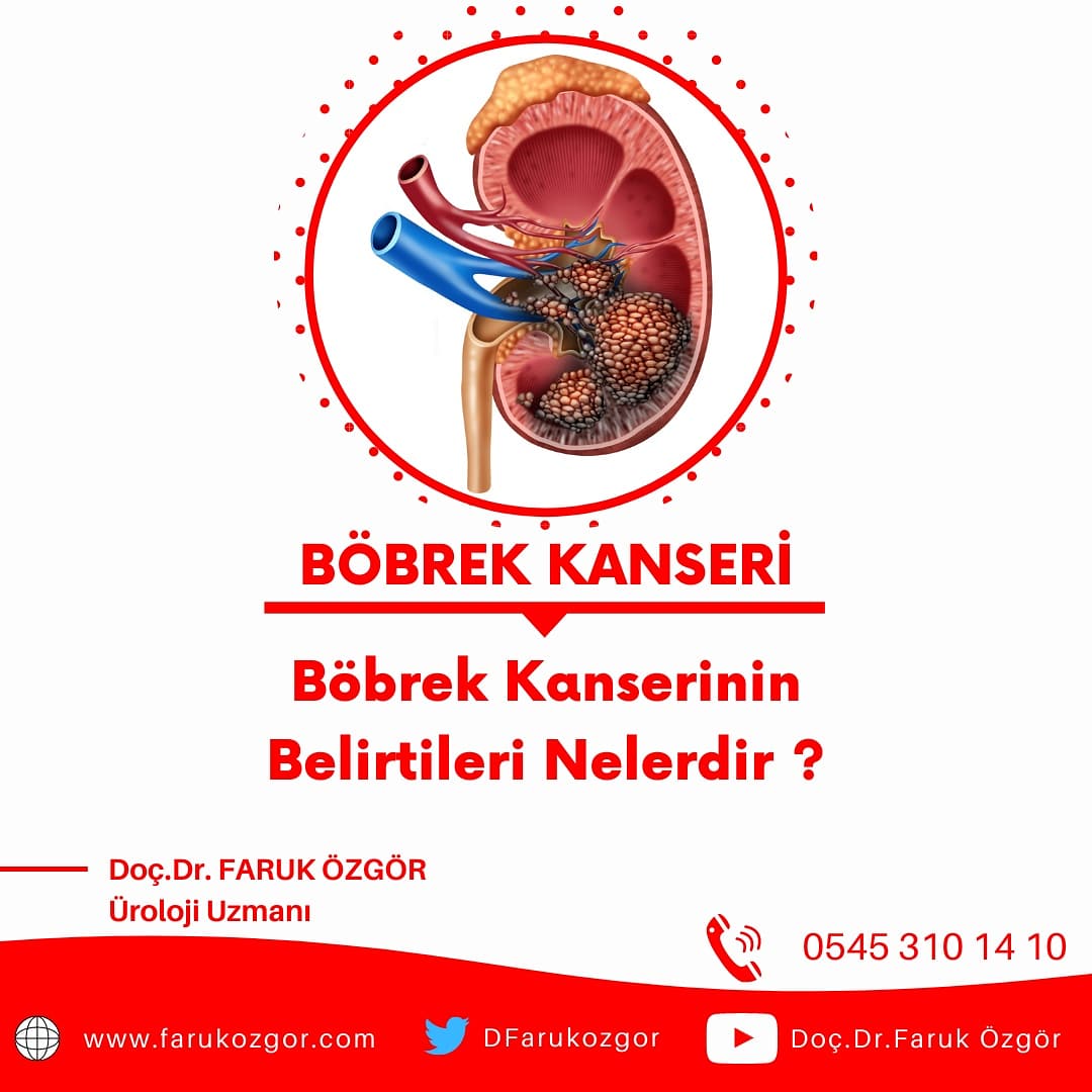 DFarukozgor's tweet photo. Böbrek kanserlerinin yaklaşık olarak %50'si hiçbir bulgu vermeden rastlantısal olarak tanı alır❗

İdrarda kanama📌

Kilo kaybı📌

Halsizlik📌

Yan ağrısı 📌

Böbrek kanserinin erken bir bulgusu olabilir 📌

Böbrek kanserlerinin en etkin tedavisi cerrahidir 💪

☎️0545 310 14 10 https://t.co/G0sTjHu79c