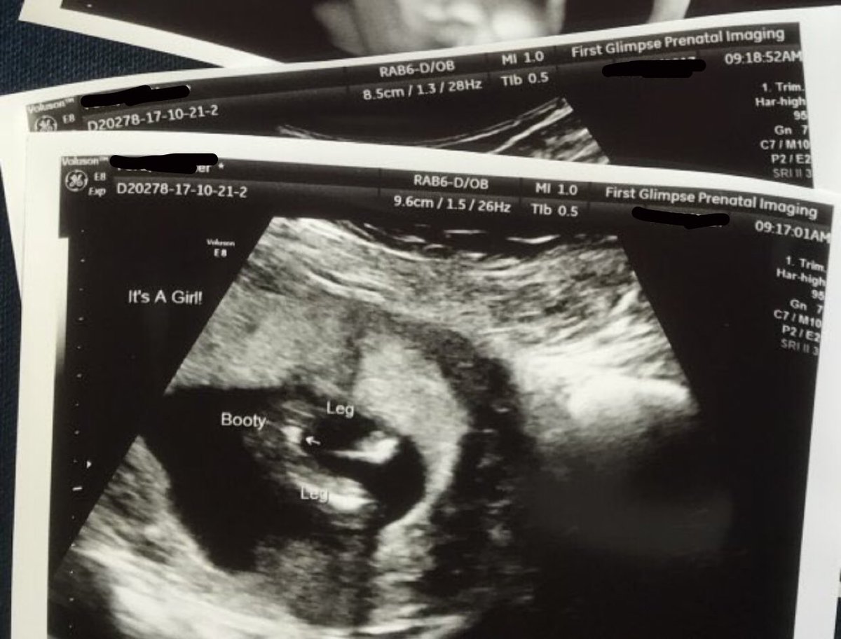 horrorsthxtic's tweet photo. We couldn’t be happier taking this next chapter in our life, and we are overjoyed to announce that baby Hood is a girl! 🌹💗 https://t.co/LqnZhEdJDa
