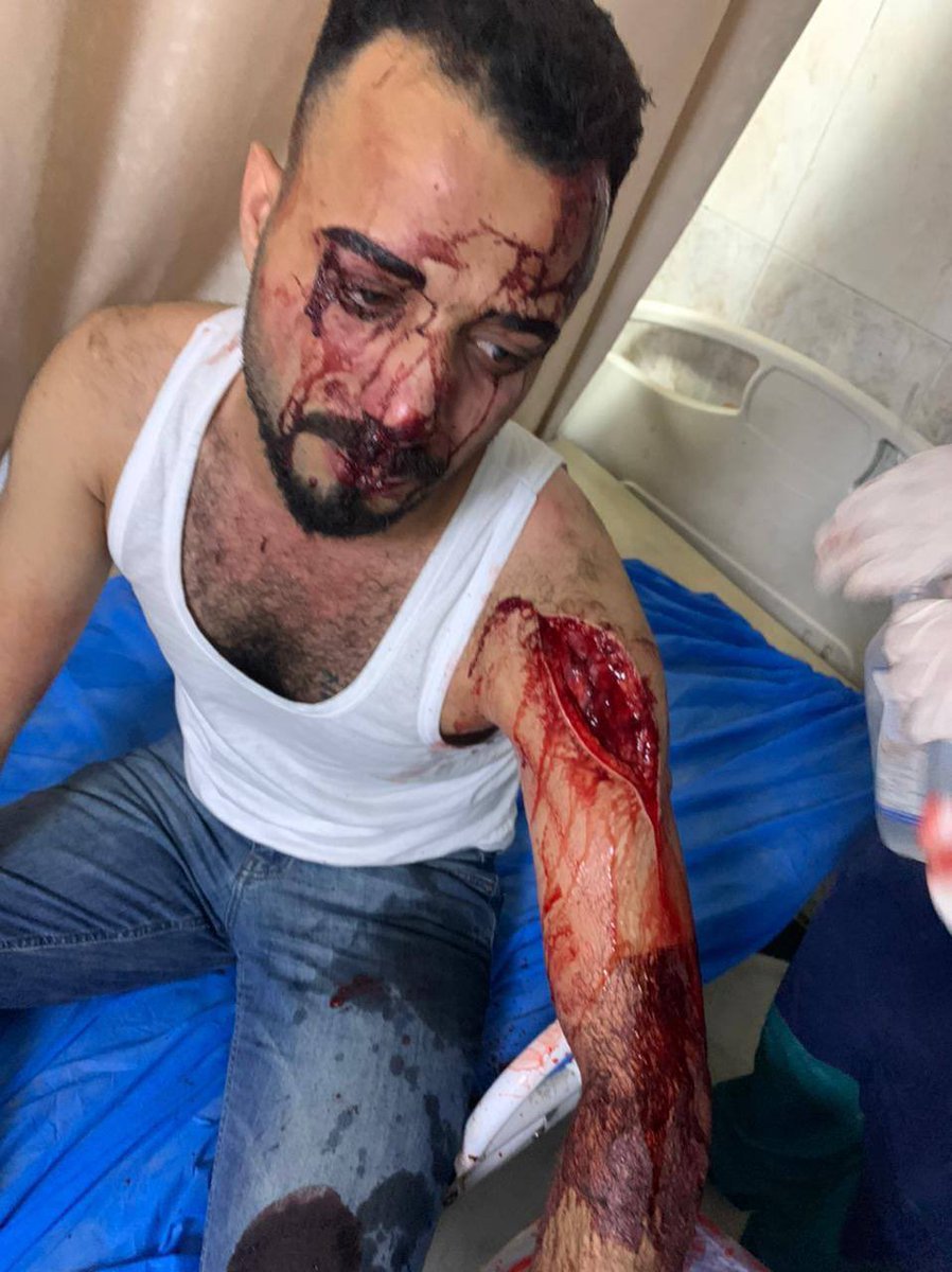 The silence of the international community over the Iraqi authorities' violations against peaceful protesters in Baghdad puts a stain on humanity, human rights values ​​and false principles of 
.freedom
{These pictures are in Iraq,not Gaza}
#العراق_يقمع
#اليونامي_شريكة_القتلة