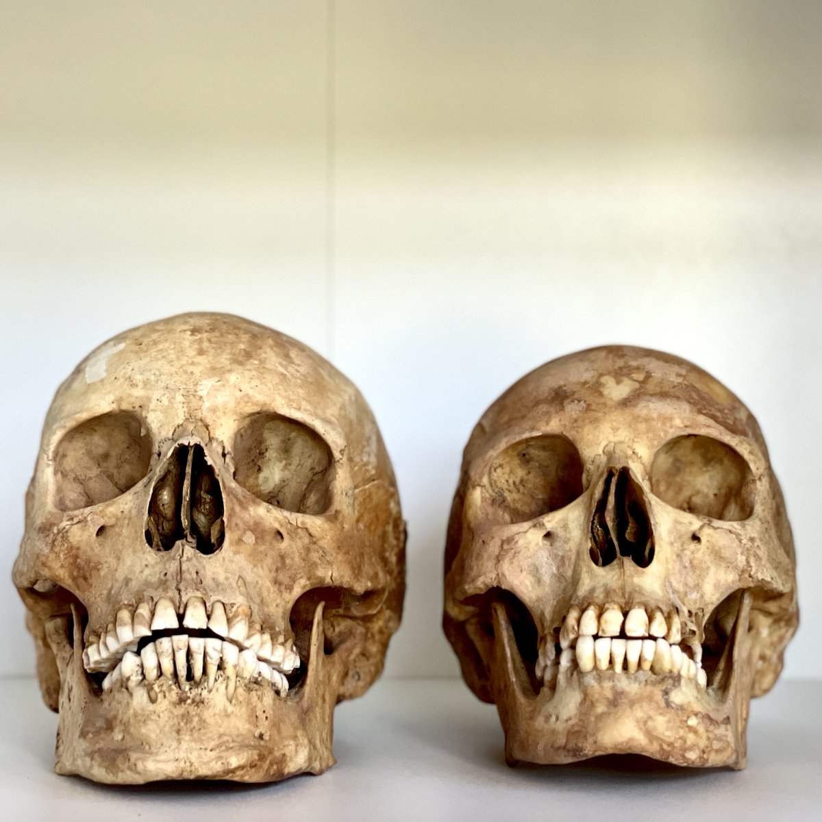 bonesforensic's tweet image. 