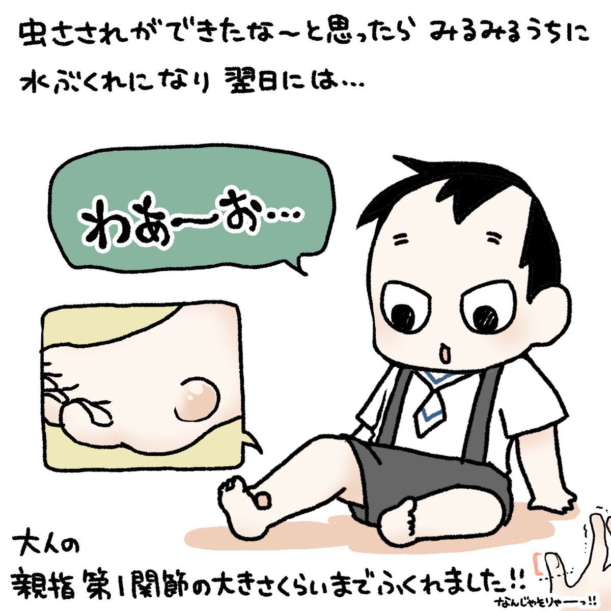 Twoucan 虫刺され の注目ツイート イラスト マンガ コスプレ モデル