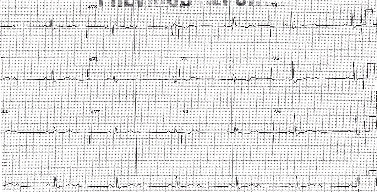 Philip J Podrid MD tweet media