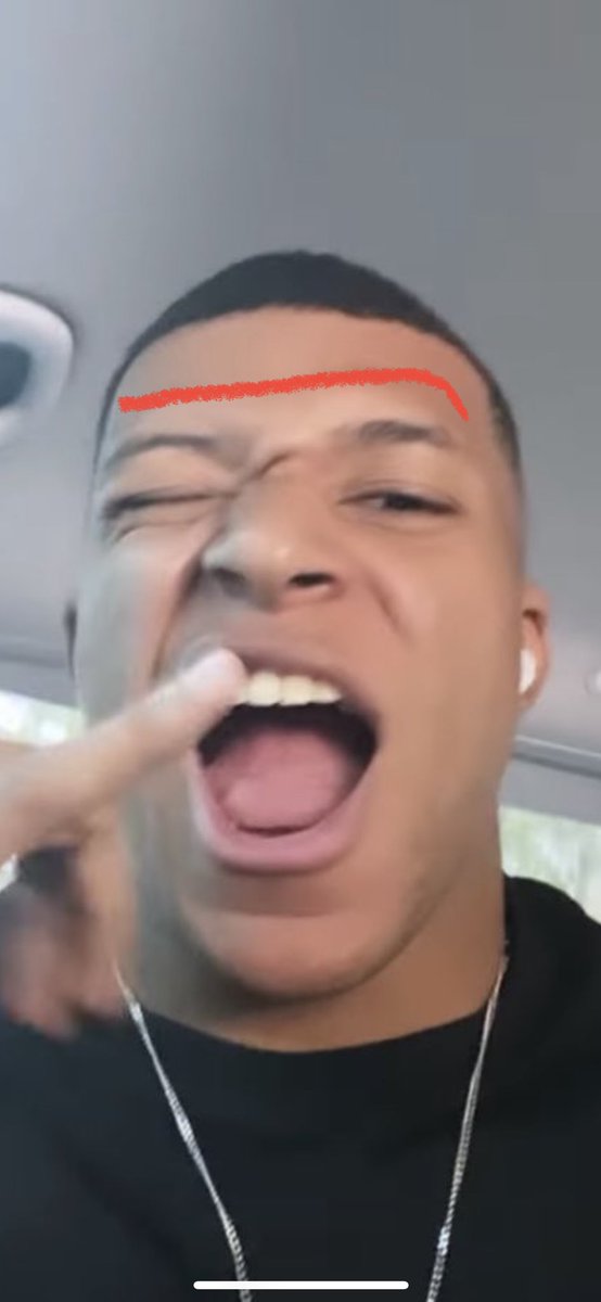 ____Joseph___'s tweet photo. Vous aimez trop faire de la propagande pour des rt. Ses cheveux ils commencent pas là https://t.co/vatwGfcfXq
