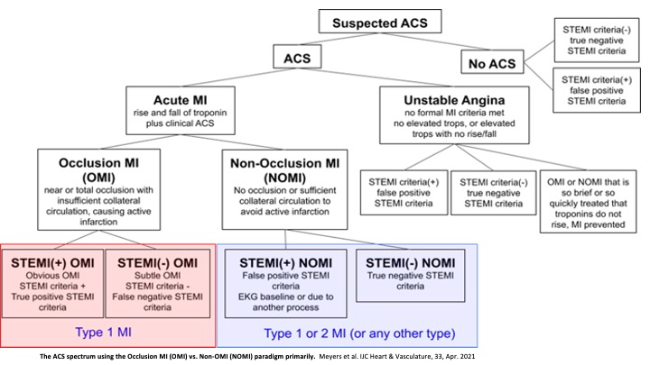 The accuracy of predefined OMI #ECG findings vs formal #STEMI criteria for the diagnosis of acute coronary occlusion MI. 
Read more:

bit.ly/32jT7jB

#cvACS #CardioTwitter #Cardiology #TweetTheJournal

@Dominik_Linz @ELS_Cardiology @ElsevierNews @BetzKonstanze