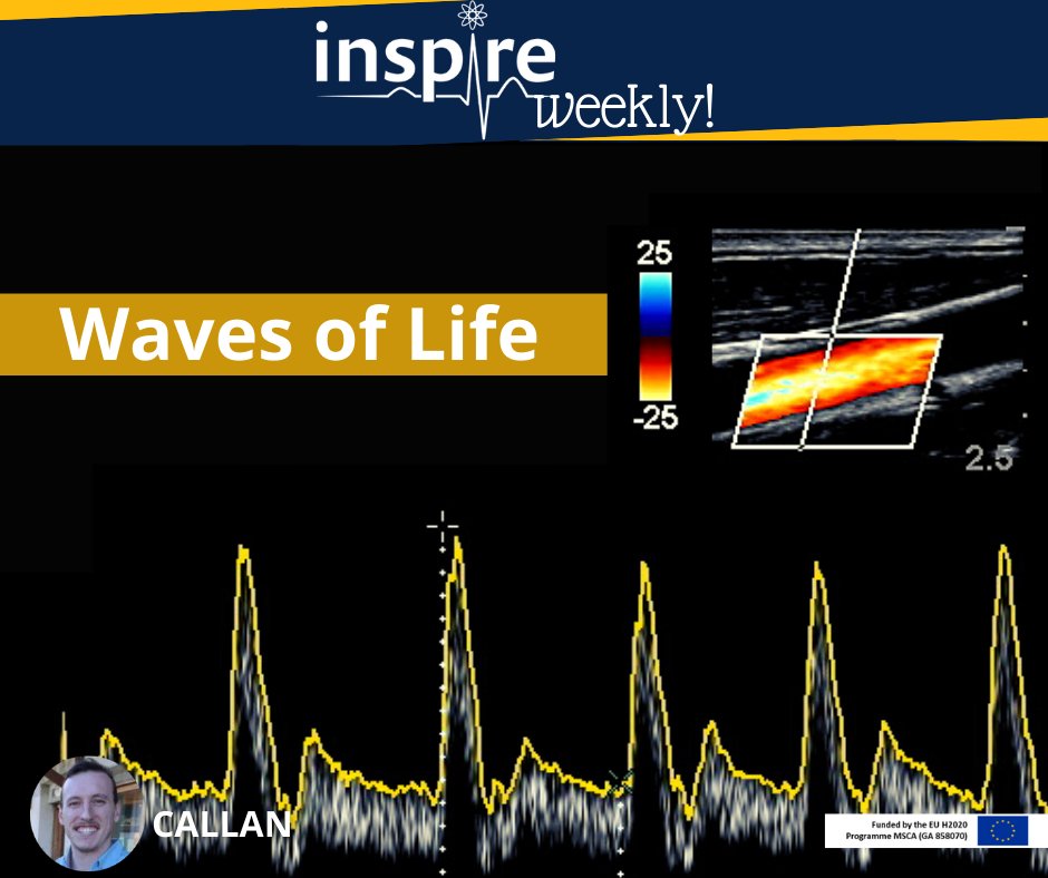 ItnInspire's tweet photo. Images made out of #ultrasonicwaves. Join us on our journey to find out! Today, Callan Wesley (#ESR10, @UAntwerpen) ultrasound imaging as a toolbox for #safetypharmacology. Read moreπhttps://t.co/jD6VzHaNcD
#H2020 #InvestEUresearch #MSCA #PhD #Cardiovasculardiseases https://t.co/QjIJFLHjzG