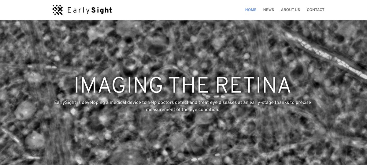 ninacapital's tweet photo. Very happy to share that our portfolio company #earlysight closed their seed round. They use a novel approach to provide a single cell level imaging of the #retina. Congratulations! Our own @sanastassiou will join the board as director https://t.co/ZkPuhuigpo https://t.co/dPIFycVxPC