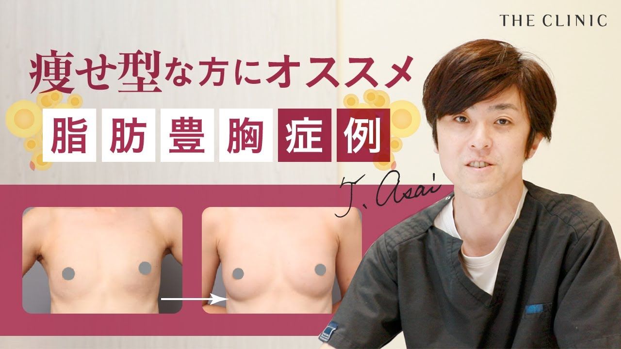 The Clinic ザクリニック 豊胸 痩せ型のバストアップ症例 スリムな方にこそオススメしたい脂肪豊胸 痩せ 型だから脂肪が取れるか心配 バストが元々小ぶりでしっかりバストアップできるか不安という方もいらっしゃると思います 今回は浅井ドクターが痩せ