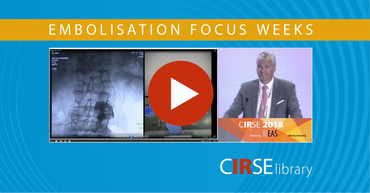 cirsesociety's tweet photo. #Endoleak - another important application for embolisation every #iRad should be familiar with. Watch this interesting case free of charge to prepare for #ET2021! https://t.co/zKe0U7437V #EmbolisationFocusWeeks https://t.co/0HQYZb9W1J