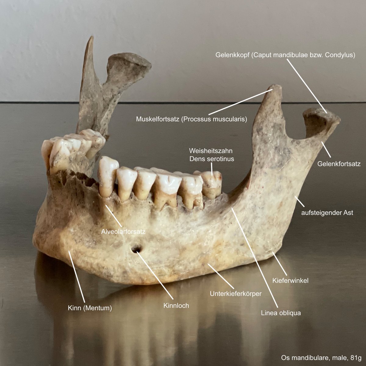 bonesforensic's tweet image. 