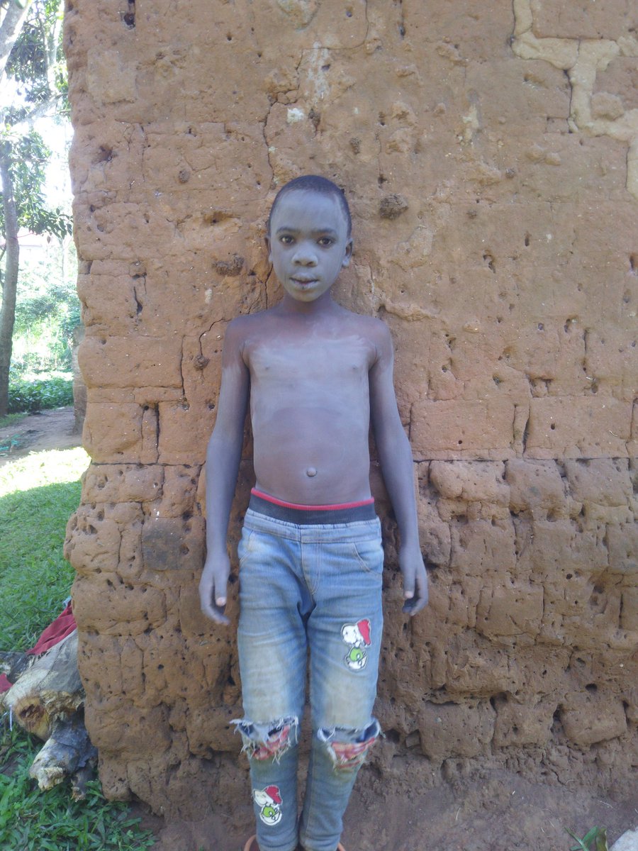 HeartsChristCh1's tweet photo. Plz brothers and Sisters, let us help this children's.
For more details send DMs.
Gmail nyonjoali2@gmail.com https://t.co/8FxRYKozXu