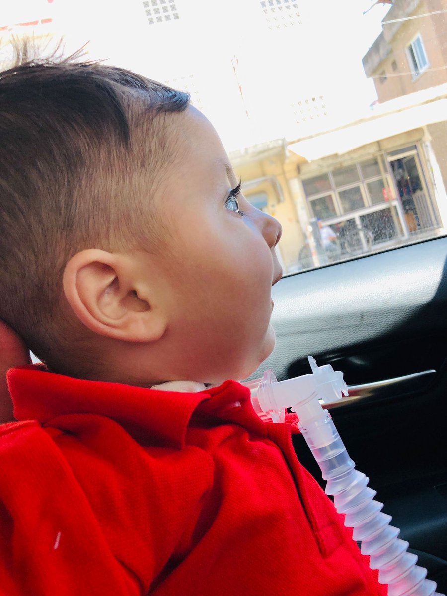 furkansmatip's tweet photo. Furkan 1 hafta kaldığı yoğun bakımdan çıktı.Eve giderken böyle şaşkınca bakıyor etrafına.Sadece hastaneye gidince dışarı çıkabiliyor.Furkan'ın kurtulması için lütfen kampanyamıza destek verin

#kaset #EmrinOlurReis #kanlıaytutulması Büyük Mustafa Ezgi Yıldız Karşıyaka Siyah Beyaz https://t.co/eD40Kl0yF5