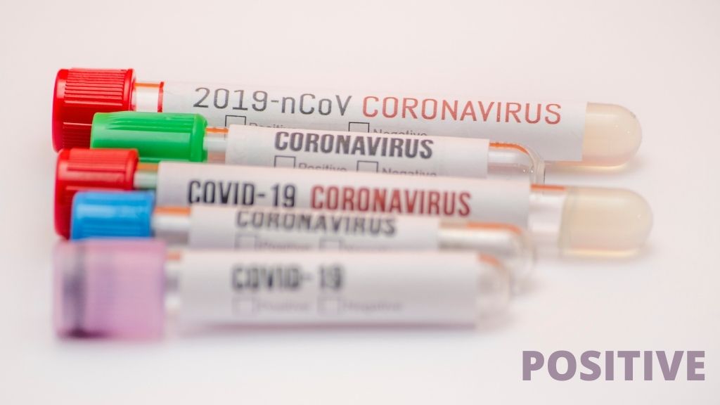 Twelve new cases of COVID 19 in St Lucia