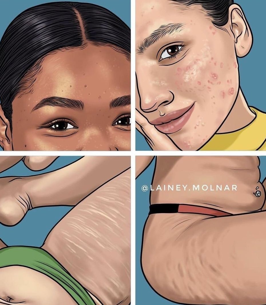 SuperheroMattre's tweet image. كلها أشياء طبيعية بس المجتمع صاير مهووس بالمثاليه والكمال